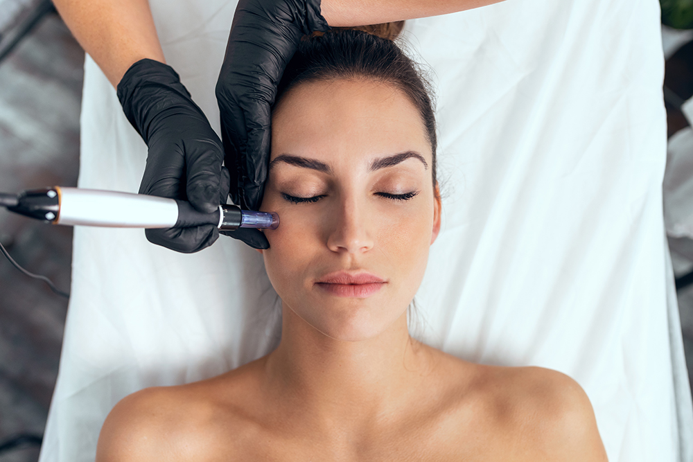 gezichtsbehandeling Huidverbetering microneedling rotterdam